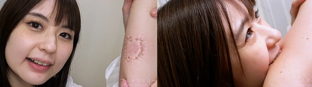 Вместо кольца — укус до крови