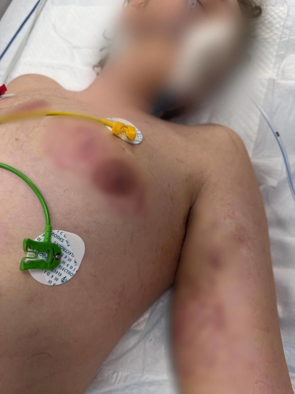 В Подмосковье задержали администратора рехаба с комнатой пыток для подростков