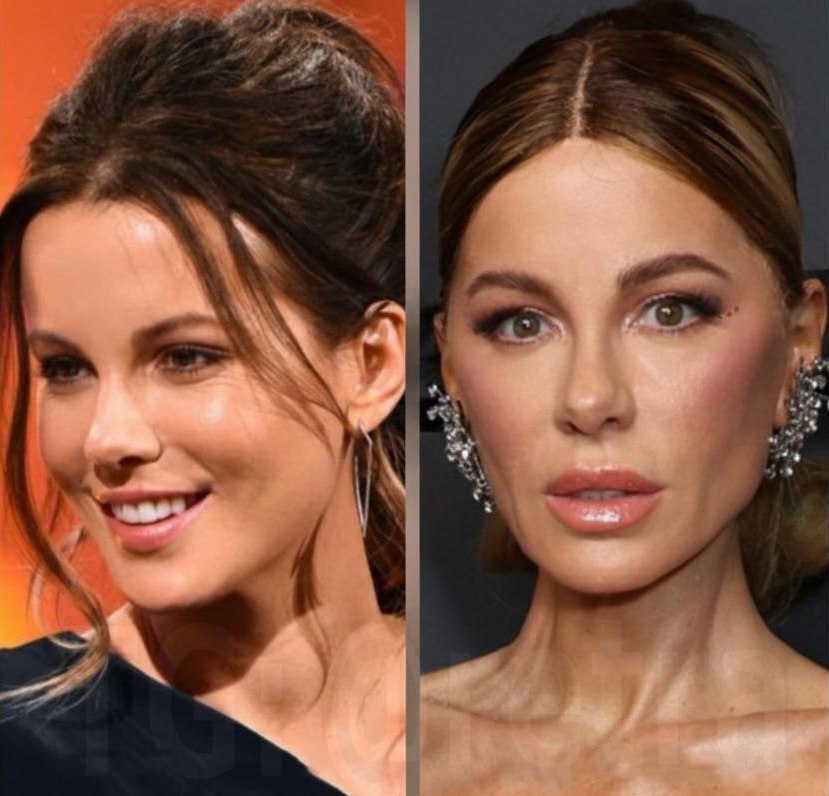 Кейт Бекинсейл неприятно удивила поклонников своим внешним видом