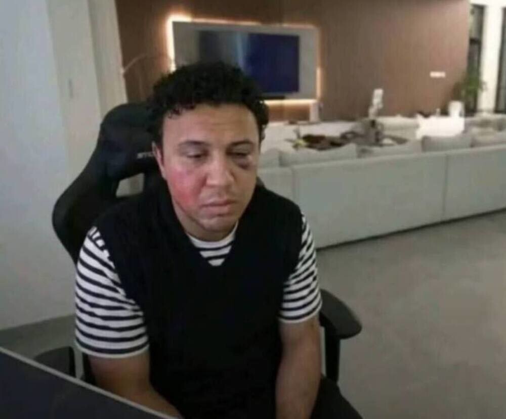 Лишенного российского гражданства блогера Субхана Мамедова избили в прямом эфире