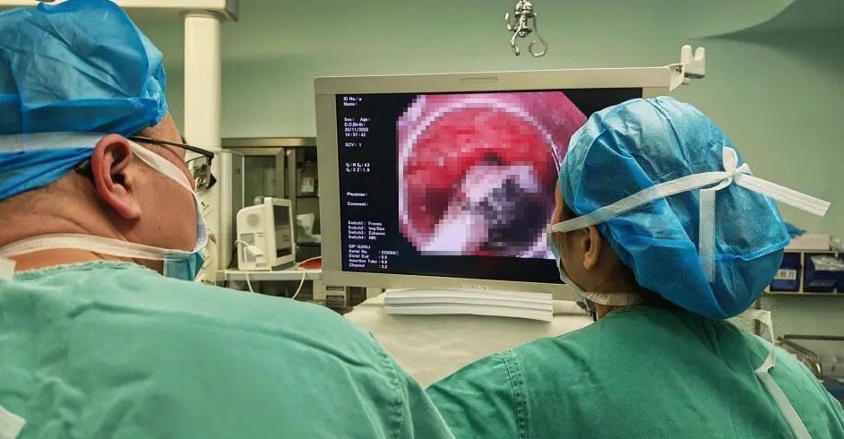 Врачи извлекли зажигалку из желудка мужчины, который в пьяном угаре проглотил её 30 лет назад