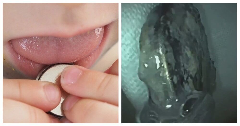 В Москве врачи спасли маленькую девочку,  проглотившую батарейку