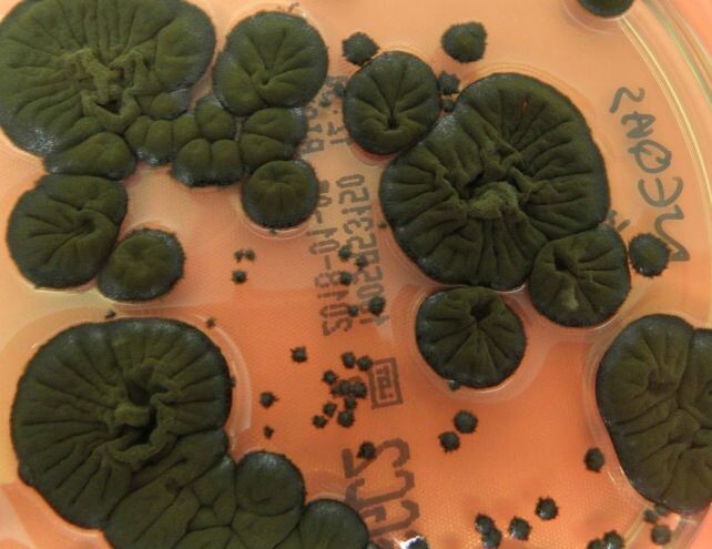 В Чернобыле нашли черный гриб, который питается радиацией