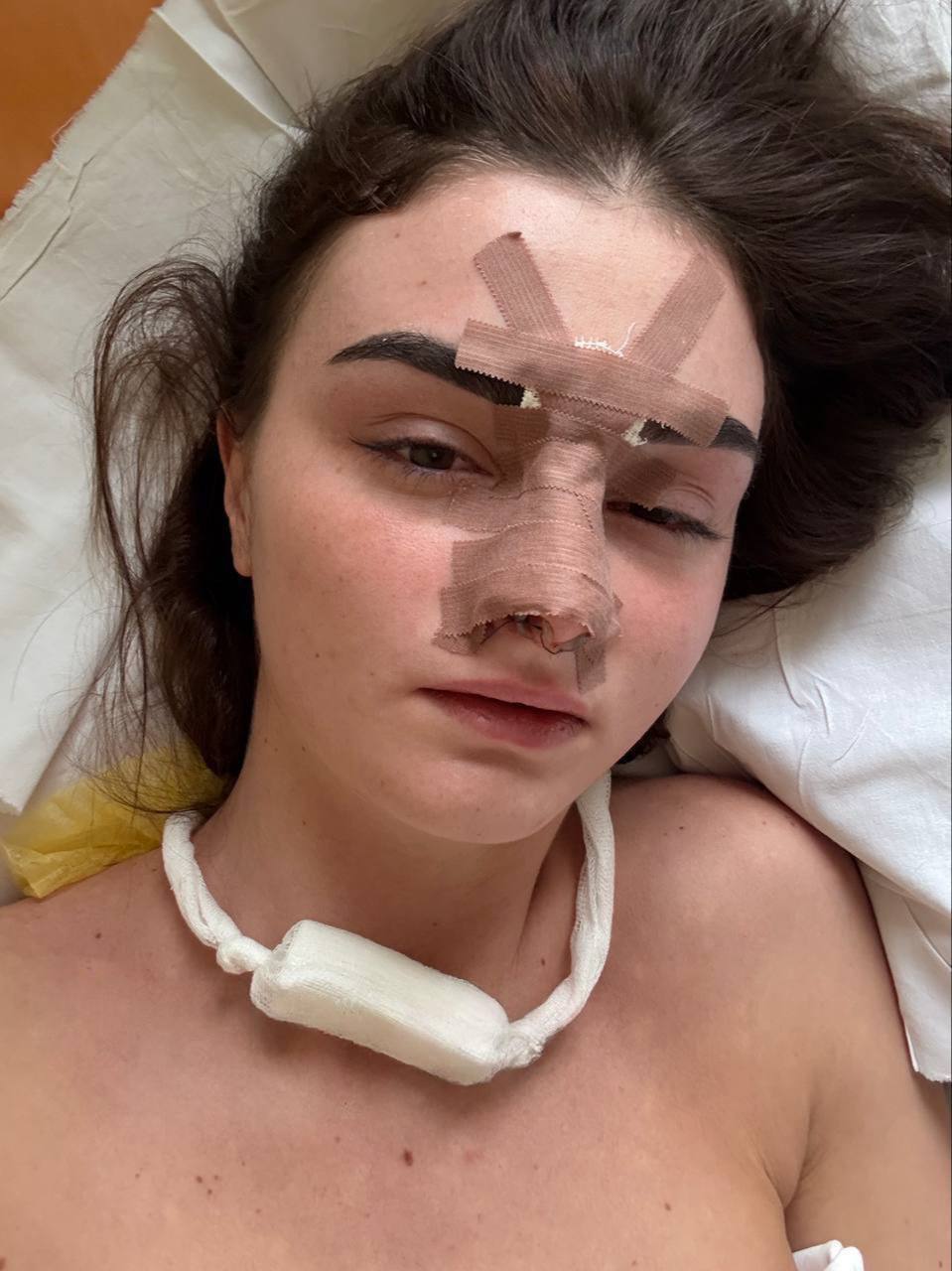 Фанат ММА из Омска избил жену и сломал ей нос из-за некачественной уборки