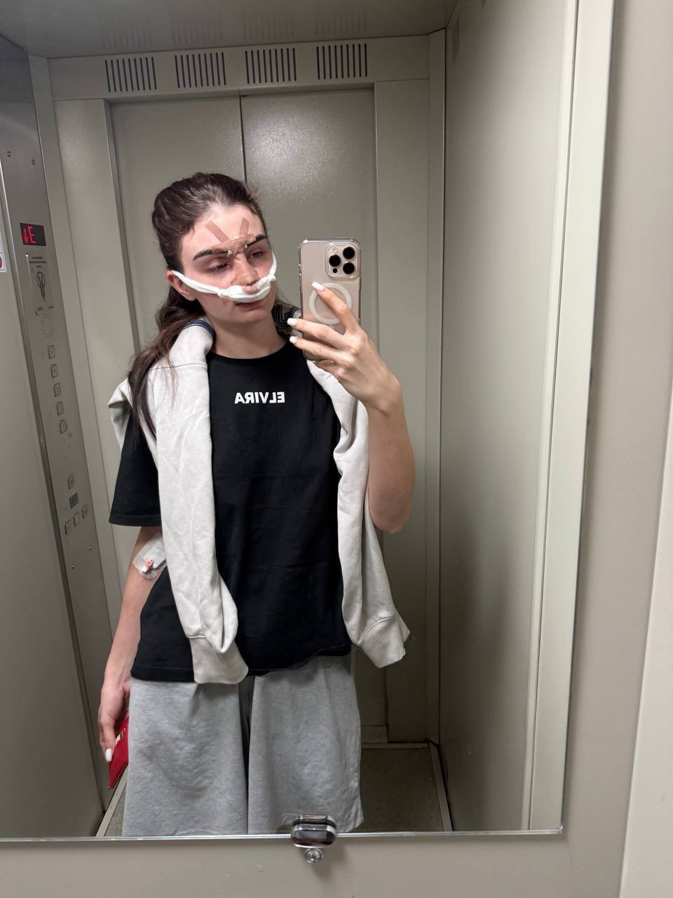 Фанат ММА из Омска избил жену и сломал ей нос из-за некачественной уборки