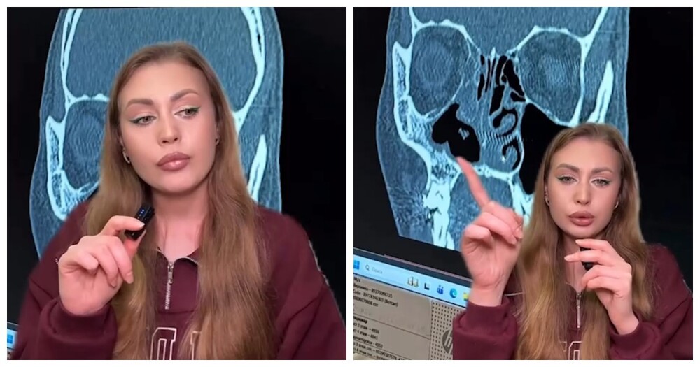 Вредная привычка обернулась для москвички провалившимся носом