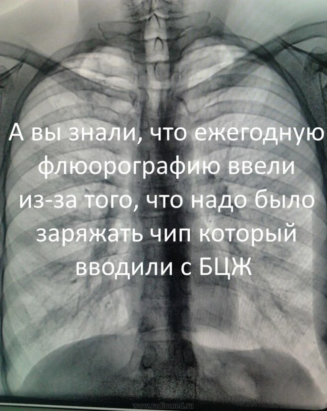 Не ищите здесь смысл. Здесь в основном маразм