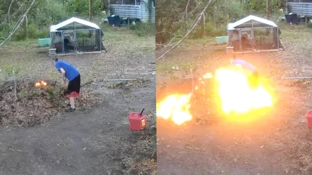 Женщина нашла самый радикальный способ удаления волос