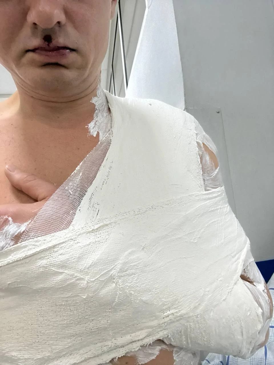 Мужчина разнял чужих детей и стал жертвой нападения старшего брата