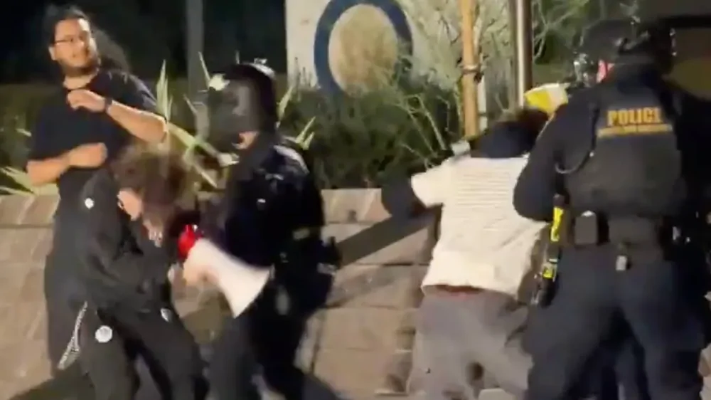 21‑летний участник протеста ослеп после выстрела в лицо