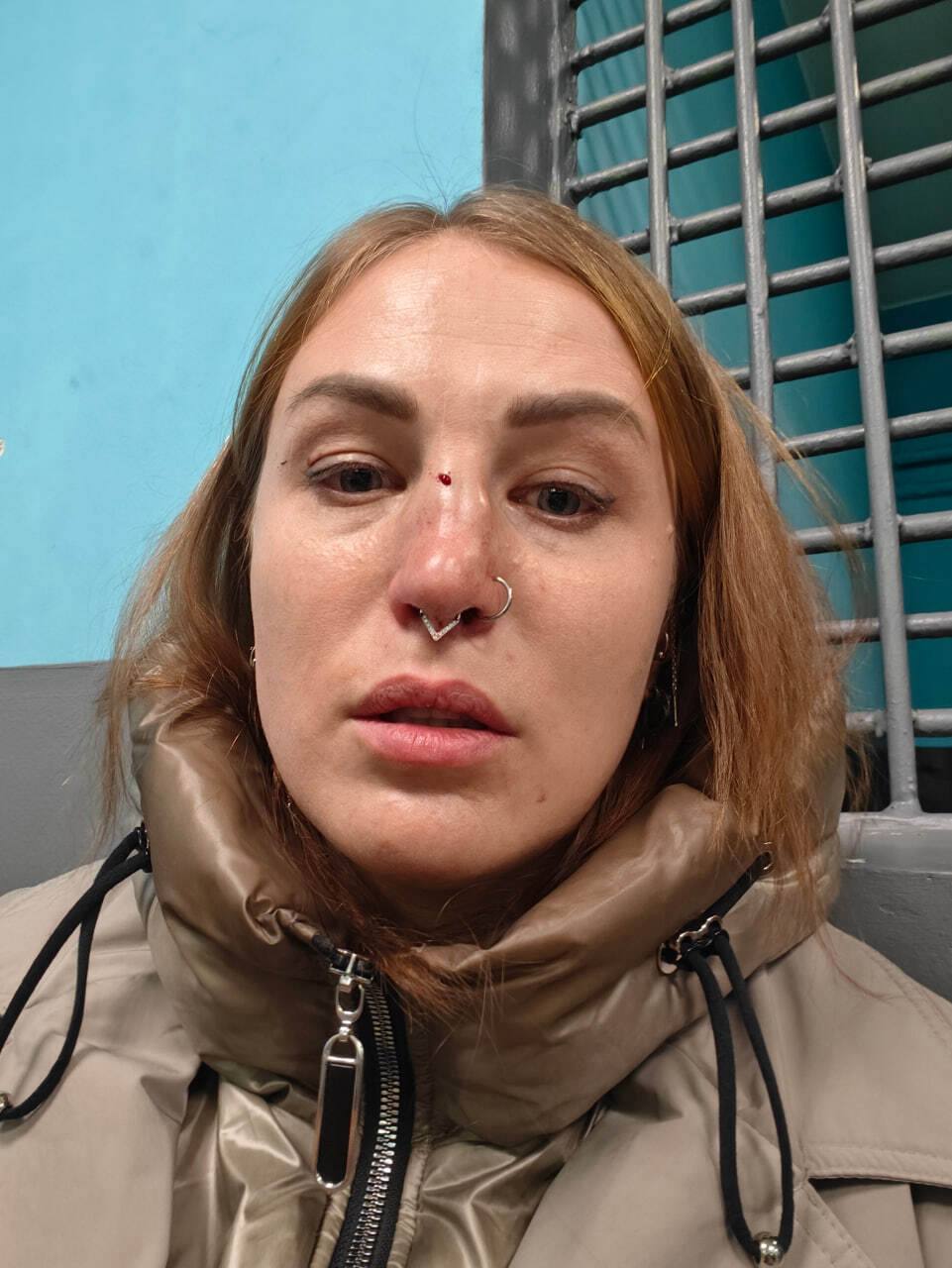 В Москве неадекват сломал девушке нос в метро из-за отказа дать деньги