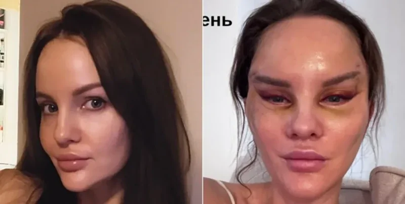 Ожидание и реальность: история одной операции