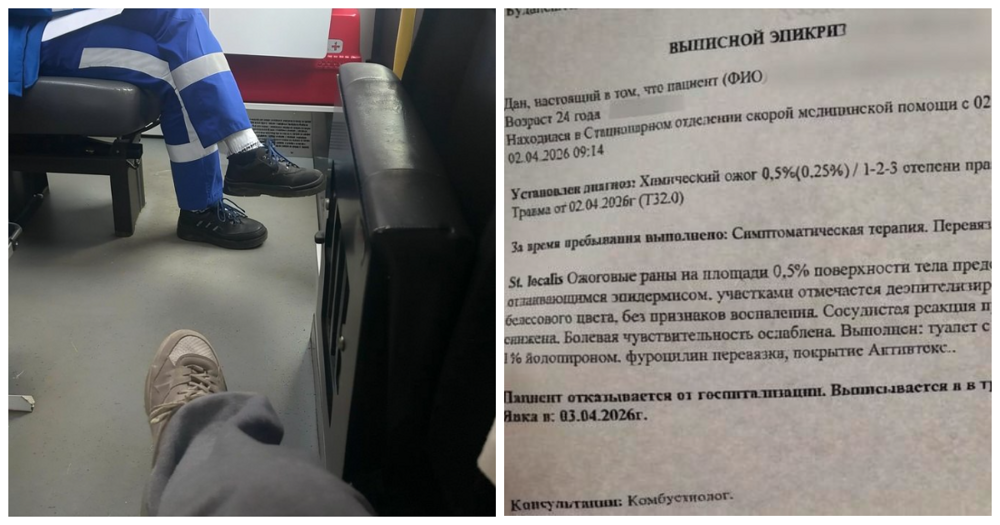 Петербурженка получила ожог ягодицы после поездки в автобусе