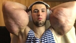 Вазелиновый качок по прозвищу Руки-Базуки попал в больницу