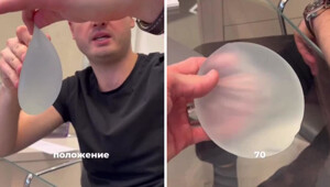 Самые дорогие импланты