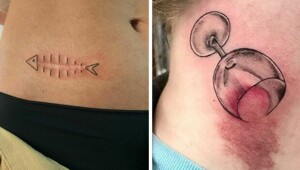 16 гениальных татуировок, которые помогли людям избавиться от шрамов и родимых пятен