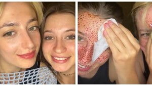 В погоне за естественной красотой: девушки нарисовали веснушки и пожалели