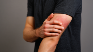 Вспышку викторианской болезни зафиксировали в Великобритании