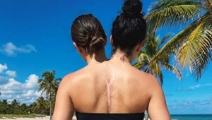 Две головы, один сервер и пустые кошельки фанатов: феномен Валерии и Камилы