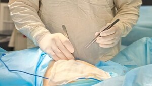34 метастатических опухоли обнаружили у молодой женщины