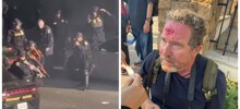 Резиновая пуля попала в&nbsp;голову фотографу во время беспорядков в Лос-Анджелесе