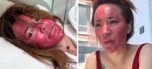 Женщина, 22 года не снимавшая макияж, осталась с красно-фиолетовым лицом