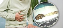Врачи извлекли зубную щётку, которую мужчина проглотил более 50 лет назад