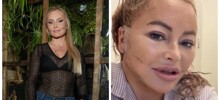 «Похожа на маму Стифлера»:&nbsp;Дана Борисова сделала пластику лица