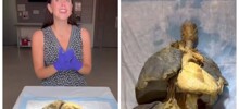 Расположение внутренних органов человека