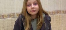 Женщина неделю лечила 10-летнюю дочь от редкой болезни, которую та нарисовала себе под глазами