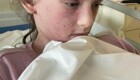 У 11-летней девочки развилась аллергия на собственные слёзы и пот