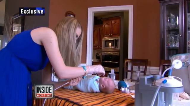 Ребёнок, родившийся без носа, настолько мил, что трогает сердца людей со всего мира