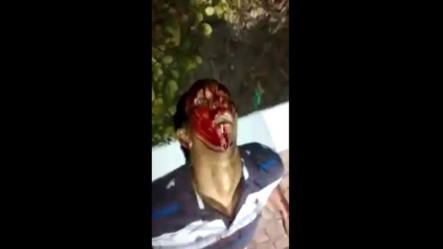 Жертва грабителя