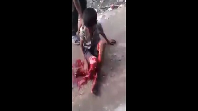 Индийский ребенок после ДТП