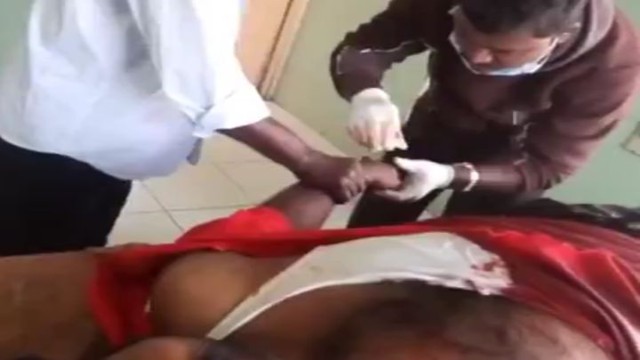 Оторвало руку