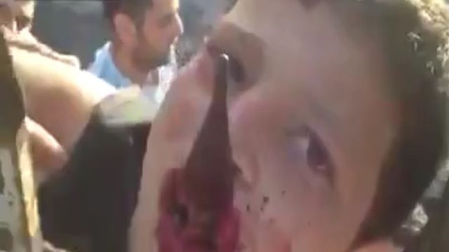 Ребенок упал на штырь забора