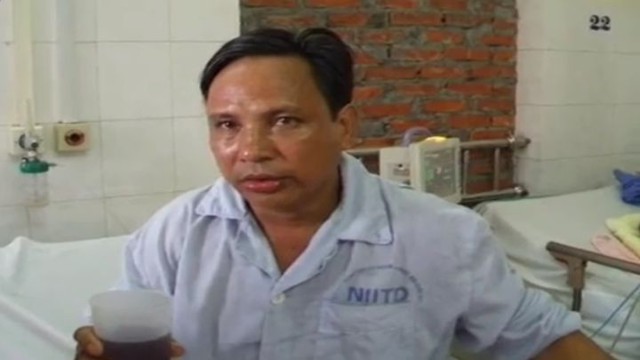 Как выглядит гидрофобия при бешенстве