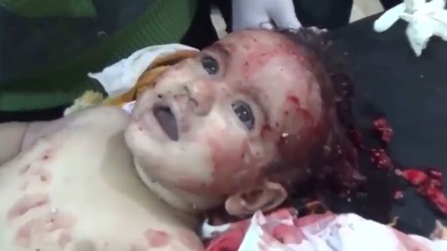 Предсмертная агония девочки в Сирии