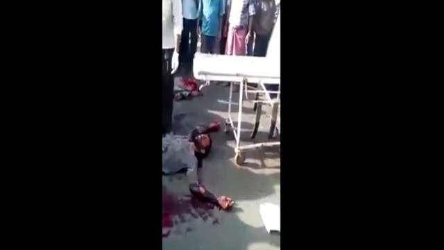 Человек разрезан пополам, но все еще жив