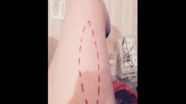 В знак протеста против коррупции в администрации Обамы, парень вырезал несколько кусков мяса из своих ног