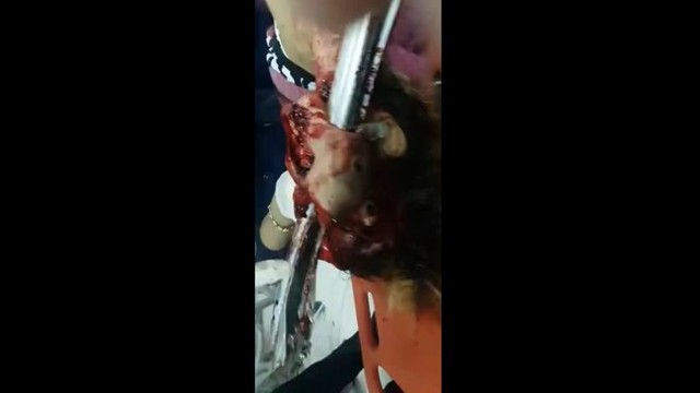 Последствия ужасного ДТП