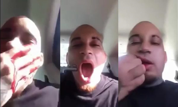 Парень выстрелил себе в щеку