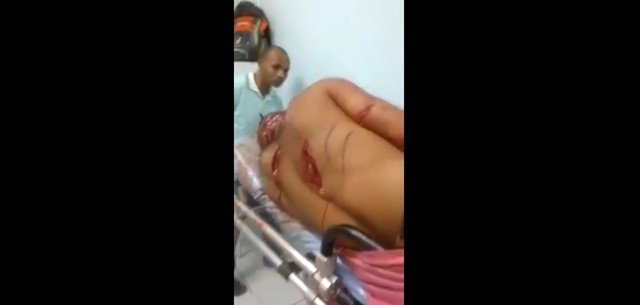 Последствия встречи с мачете