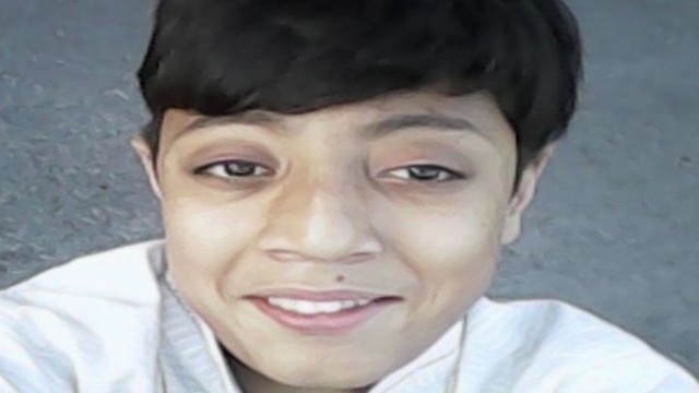 Подросток научился выдавливать свои глазные яблоки из глазниц и теперь мечтает стать мировым рекордсменом