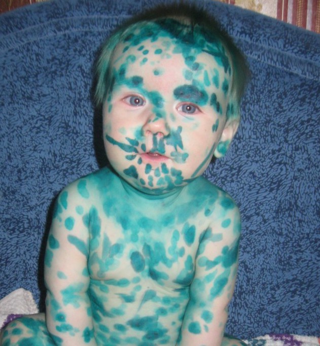 История о том, как я Вовку лечил... (1 фото)