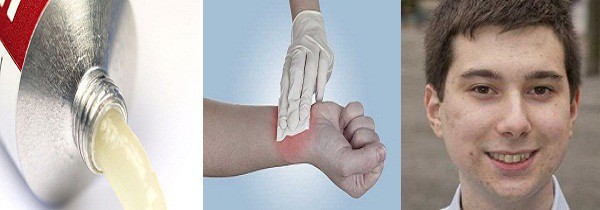 Студент изобрел чудо-гель, мгновенно заживляющий раны