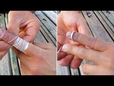 Как снять застрявшее кольцо с пальца