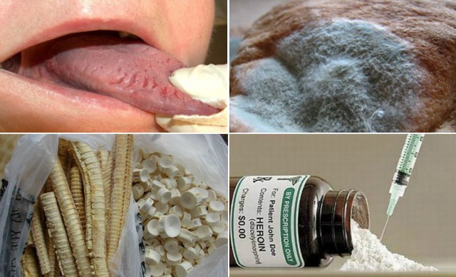 12 самых невероятных лекарств из прошлого