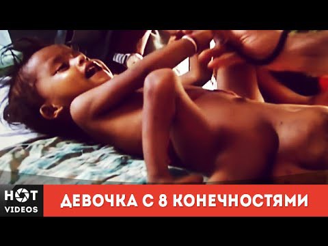 8 конечностей. Божество и наказание