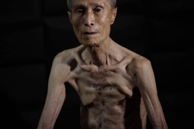 Изуродованное тело жертвы бомбардировки Нагасаки